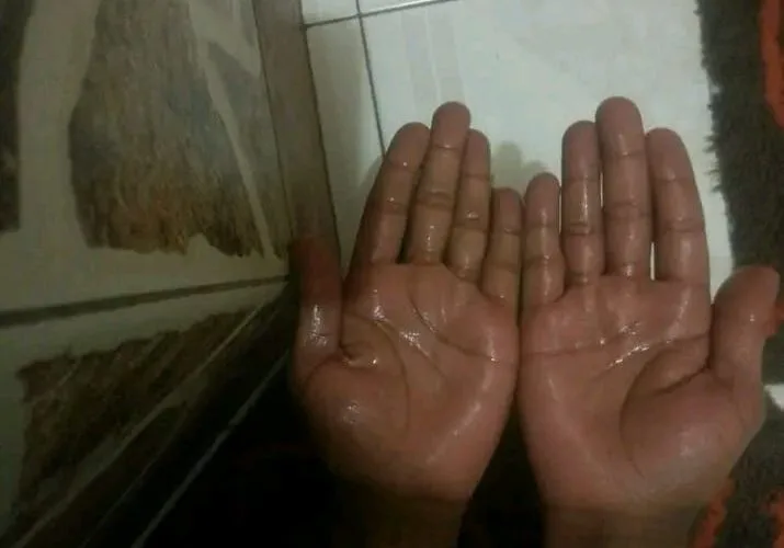 thumb